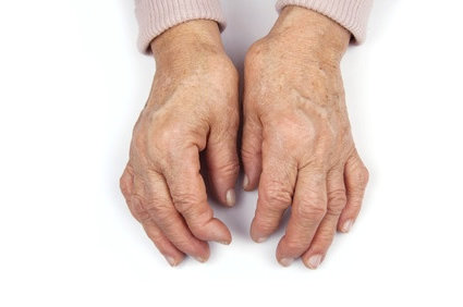 Como é a osteoartrite?