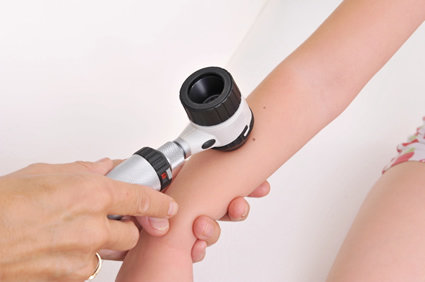 O que é pênfigo? O que devo saber sobre ele?