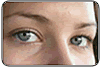 Olhos vermelhos? Pode ser conjuntivite.