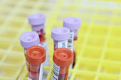 Anemia infantil - quais s&atilde;o as caracter&iacute;sticas e o que pode ser feito?