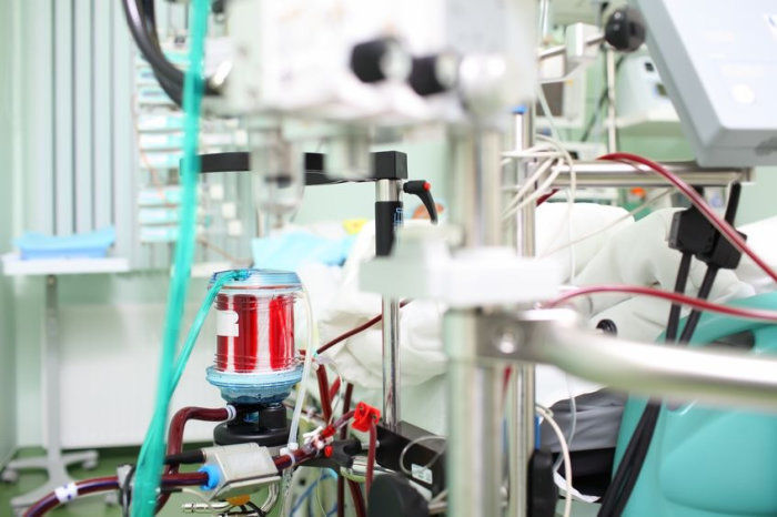 O que é ECMO e seu uso no tratamento da Covid-19
