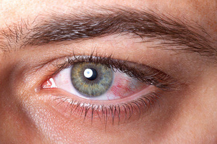 A presença de sangue nos olhos