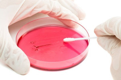 A resistência aos antibióticos e as superbactérias