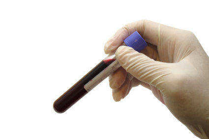 Acidose: o que é importante conhecer?