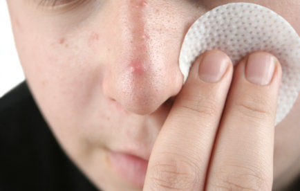 Acne: como melhorar o aspecto da sua pele?
