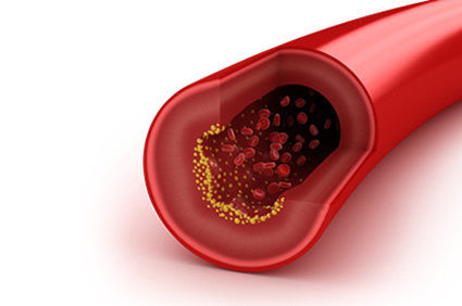 Arteriografia ou angiografia: como é o exame? Como se preparar? Quando deve ser realizado? Quais os riscos?