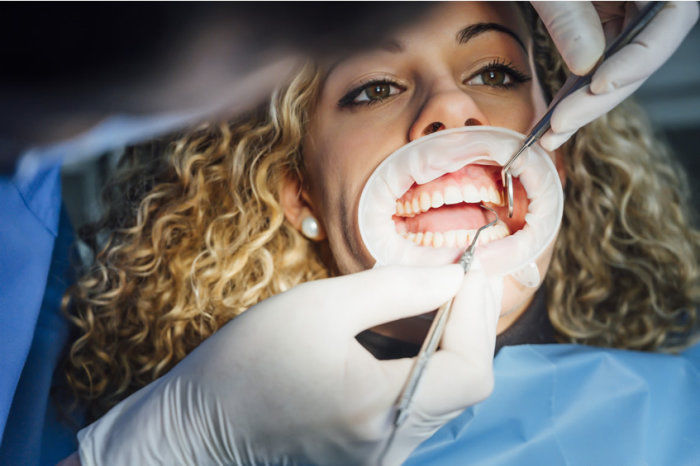 Dentes do siso: qual é a questão?