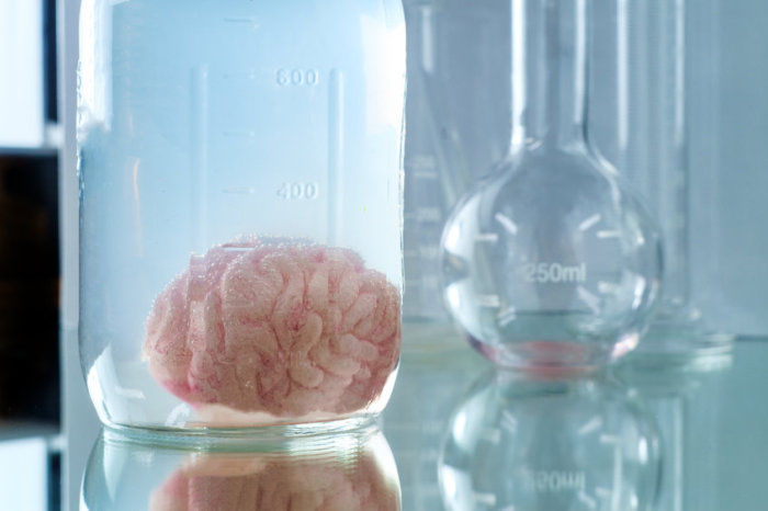 Deriva&ccedil;&atilde;o ventriculoperitoneal