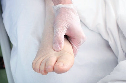 Edema ou incha&ccedil;o - causas, sintomas e tratamento