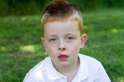 Impetigo: conceito, causas, sintomas, diagnóstico, tratamento, evolução, prevenção, complicações possíveis