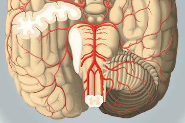 Insuficiência vertebrobasilar: o que é isso?