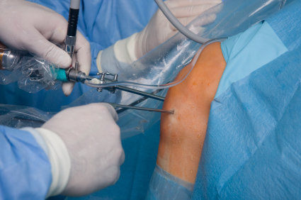 Laparoscopia: o que é? Como é? Quais são as desvantagens e os riscos?