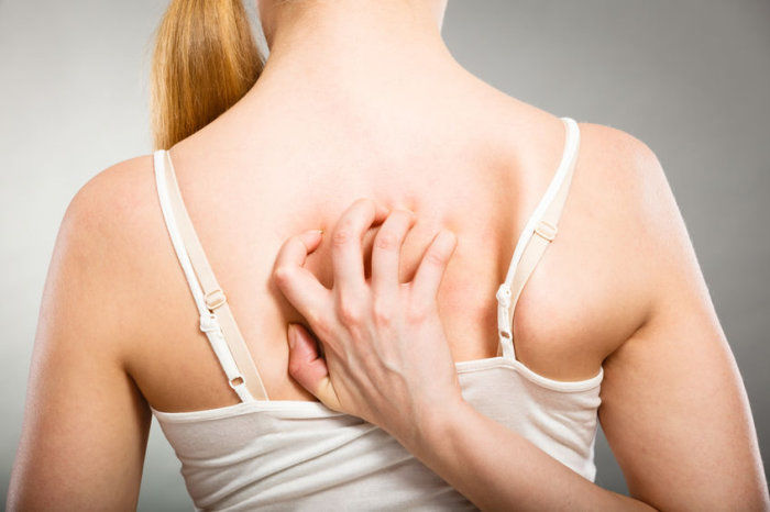 Notalgia parestésica - o que é isso?