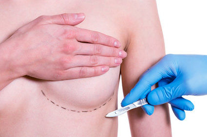 Prótese da mama ou Mamoplastia