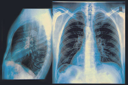 Radiografia contrastada: o que &eacute;? Por que fazer? Como &eacute; feita?