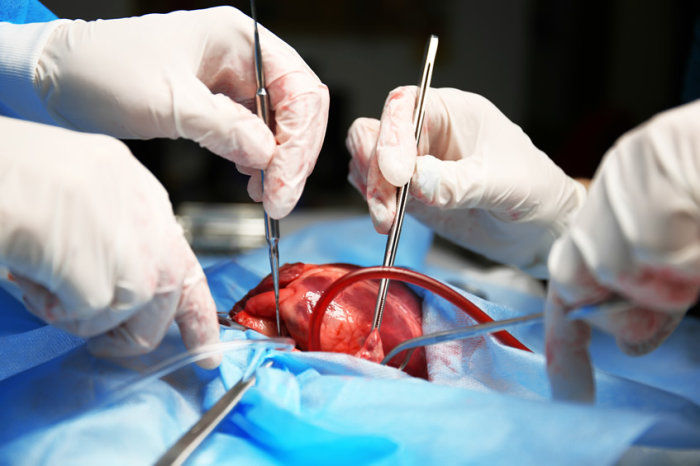 Transplante cardíaco
