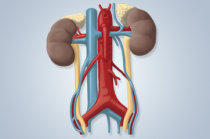 Cintilografia renal