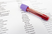 Exames laboratoriais básicos de sangue