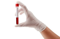 Grupos sanguíneos: quais são? Como são a compatibilidade e a incompatibilidade entre sangues de tipos diferentes?