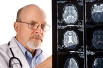 O que devemos saber sobre o edema cerebral?