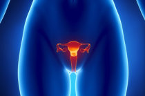 Pólipos uterinos: saiba mais sobre o que eles significam