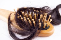 Queda de cabelo: causas, diagnóstico, tratamento e prevenção para homens e mulheres