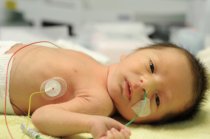 Sofrimento fetal ou hipóxia neonatal: como é?