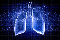 Transplante de pulmão - como é o procedimento?