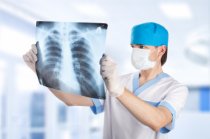 “Água no pulmão” ou derrame pleural: o que é isso? Quando ocorre? Como são o diagnóstico e o tratamento?