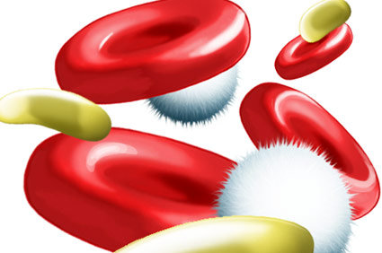 Conhe&ccedil;a a mielodisplasia: suas causas, sintomas, diagn&oacute;stico, tratamento e evolu&ccedil;&atilde;o