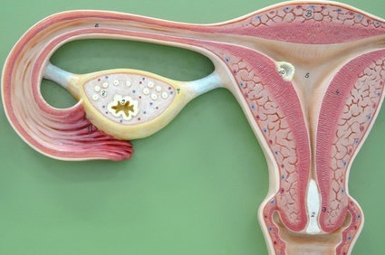 Endometrite: o que é?