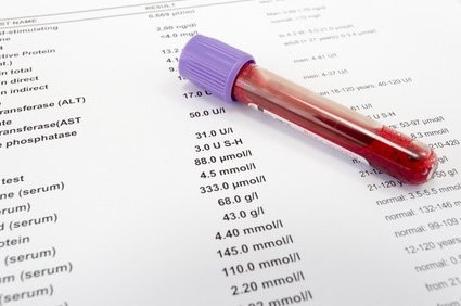 Exames laboratoriais básicos de sangue - Exames e Procedimentos > AbcMed