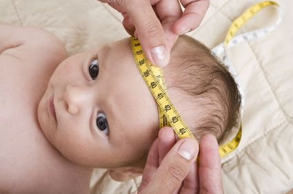 Microcefalia: conceito, causas, sintomas, diagnóstico, tratamento, prevenções, possíveis complicações