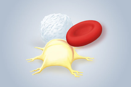 Mieloma múltiplo: saiba mais sobre esta condição