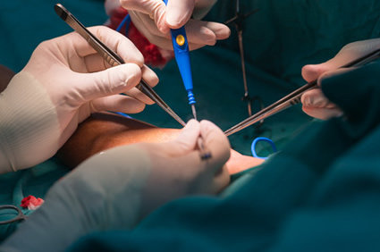 O que são fístulas?