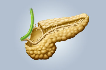 Pancreatite crônica