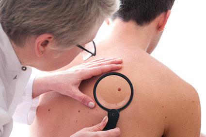 Pintas na pele: causas, sinais e sintomas, diagnóstico, tratamento, prevenção, possíveis complicações