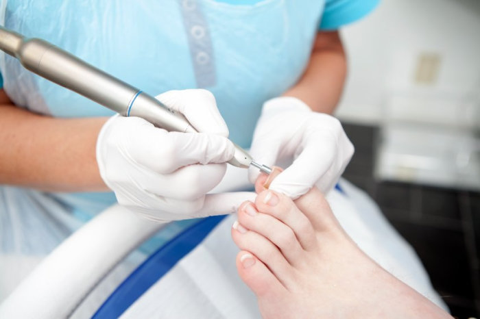 Podólogo ou pedicure?