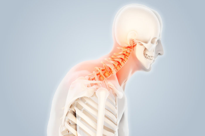 Síndrome da costela cervical