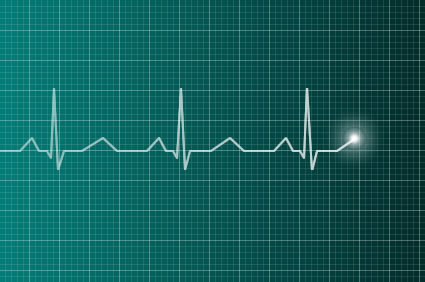 Taquicardia ventricular