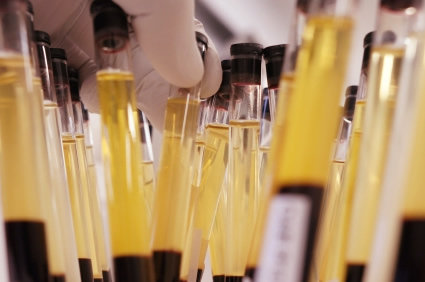 Velocidade de hemossedimentação (VHS)