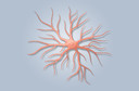 Astrocitoma: conceito, causas, clínica, diagnóstico, tratamento, evolução