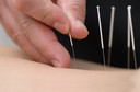 Em que consiste a acupuntura?