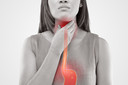 Esofagite de refluxo - como é? Quais são as medidas preventivas?