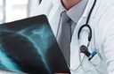 Fibrose pulmonar ou Doença Intersticial Pulmonar: causas, sintomas, diagnóstico e tratamento