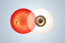 Fundo de olho ou fundoscopia: como é realizado? Quem deve fazer? O que este exame pode diagnosticar?