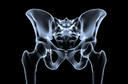 Osteossarcoma - como é? Qual a evolução? Como tratar?