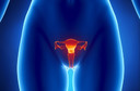 Pólipos uterinos: saiba mais sobre o que eles significam