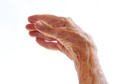 Por que meus dedos estão ficando tortos e doloridos? Pode ser artrose? Conheça esta condição e ajude a preveni-la