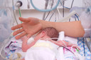 Retinopatia do bebê prematuro